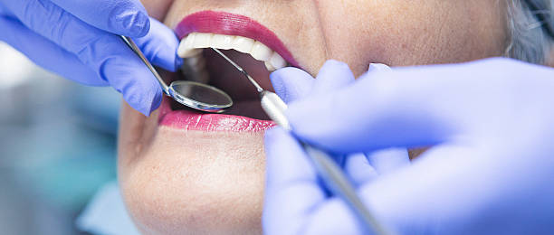 Best Emergency Dental Extractions in Kingston, NJ